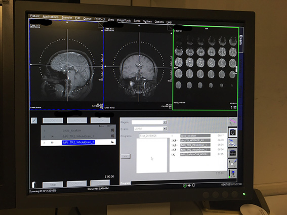 MRI 1