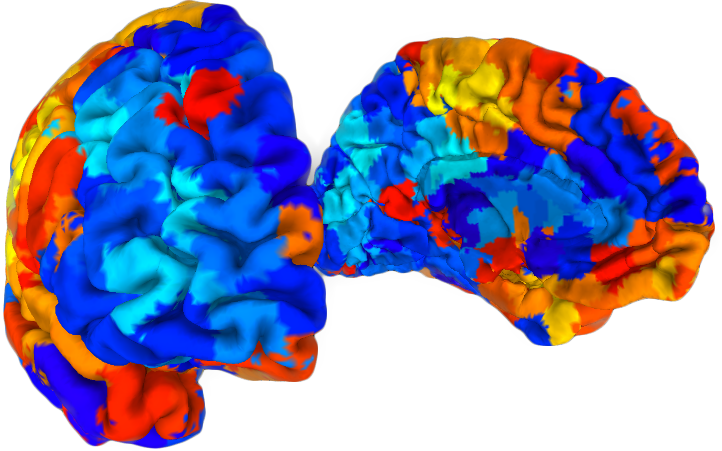 brain1