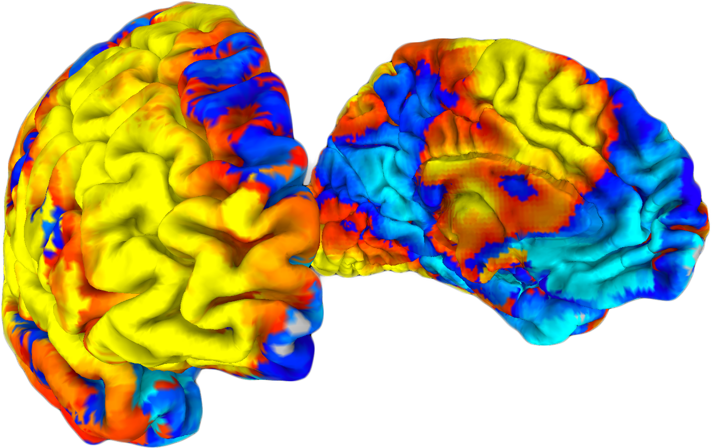 brain2